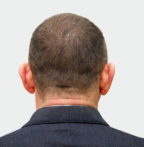 79ad592b07357364977f6ef243138071